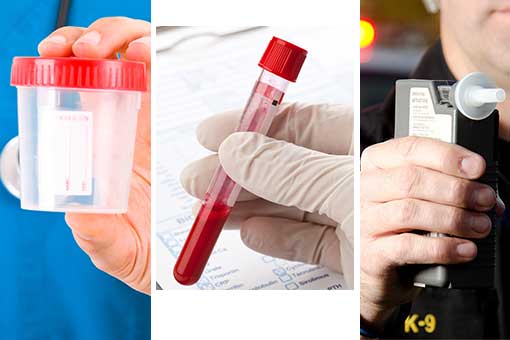 Chemical Test in Ohio - Urine, Blood and Breathalyzer